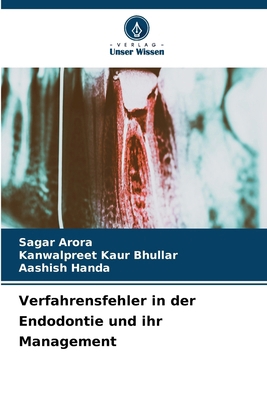 Verfahrensfehler in der Endodontie und ihr Mana... [German] 6209156762 Book Cover
