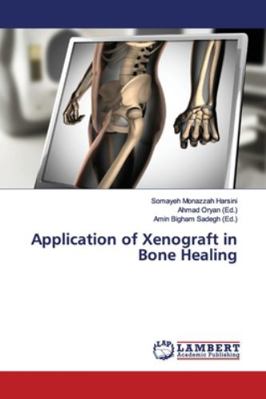 Application of Xenograft in Bone Healing 6139448581 Book Cover