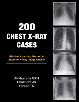 200 Chest X-Ray Cases 1905006365 Book Cover