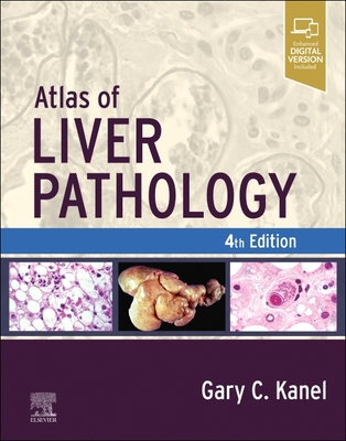 Atlas of Liver Pathology 0323825338 Book Cover