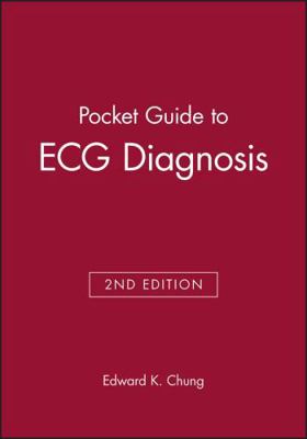 Pocket Guide to ECG Diagnosis B000WG8TC8 Book Cover