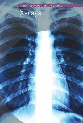 X-Rays 1502627787 Book Cover