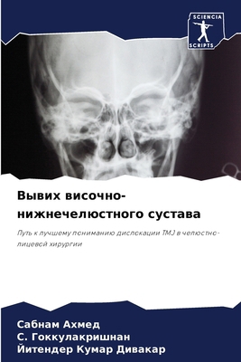 Вывих в
... [Russian] 6207621077 Book Cover