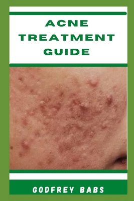 Acne Treatment Guide: Manage acne with ease B0CYSHDZXY Book Cover