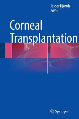 Corneal Transplantation 3319352717 Book Cover