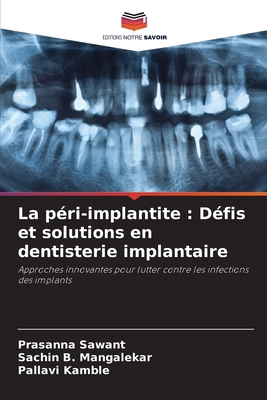 La péri-implantite: Défis et solutions en denti... [French] 6208611563 Book Cover