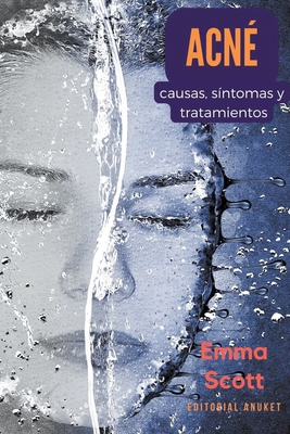 Acné: Causas, Síntomas y Tratamientos [Spanish] B0CN611DYS Book Cover