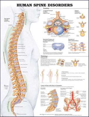 Human Spine Disorders Anatomical Chart 1587794659 Book Cover
