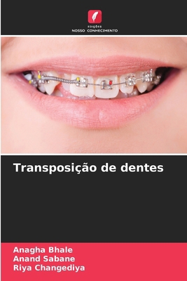 Transposição de dentes [Portuguese] 6209695043 Book Cover