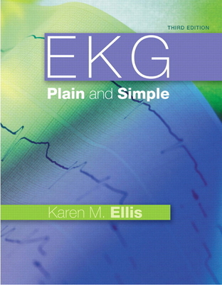 EKG: Plain and Simple 0132377292 Book Cover