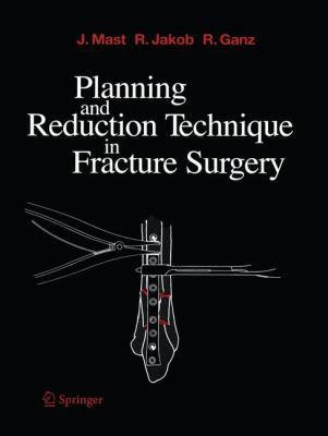 Planning and Reduction Technique in Fracture Su... 3642647847 Book Cover