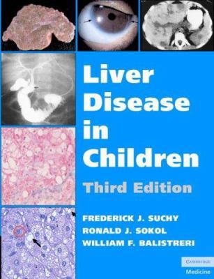 Liver Disease in Children 0521856574 Book Cover