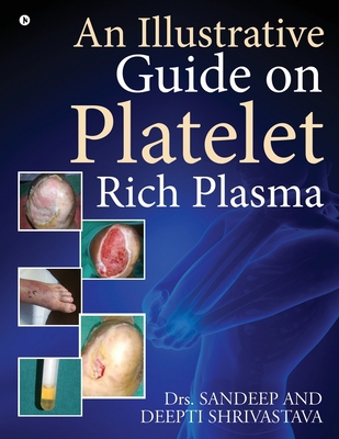 An Illustrative Guide on Platelet Rich Plasma 1646786114 Book Cover