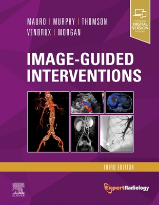 Image-Guided Interventions: Expert Radiology Se... 0323612040 Book Cover