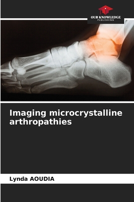 Imaging microcrystalline arthropathies 6208087740 Book Cover