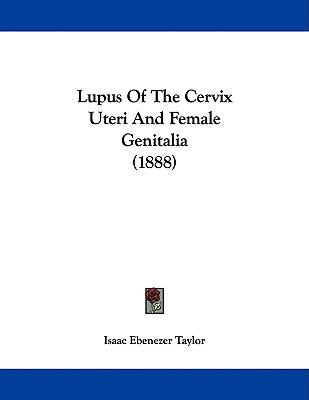 Lupus Of The Cervix Uteri And Female Genitalia ... 110423761X Book Cover