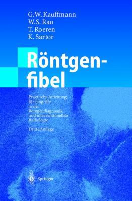 Röntgenfibel: Praktische Anleitung Für Eingriff... [German] 354041018X Book Cover