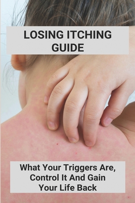 Losing Itching Guide: What Your Triggers Are, C... B092L13JQY Book Cover