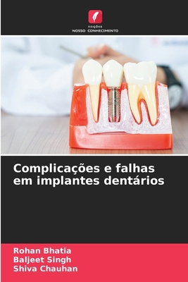 Complicações e falhas em implantes dentários [Portuguese] 620823266X Book Cover