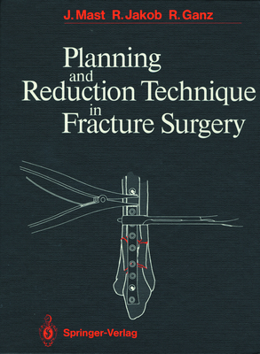 Planning and Reduction Technique in Fracture Su... 3540162836 Book Cover