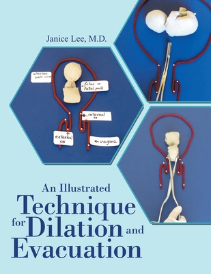 An Illustrated Technique for Dilation and Evacu... 168470068X Book Cover