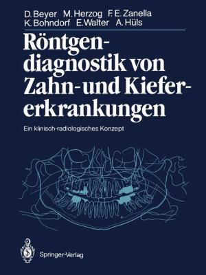 Röntgendiagnostik Von Zahn- Und Kiefererkrankun... [German] 3642710646 Book Cover