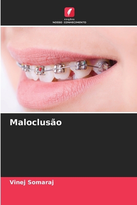 Maloclusão [Portuguese] 6205626551 Book Cover
