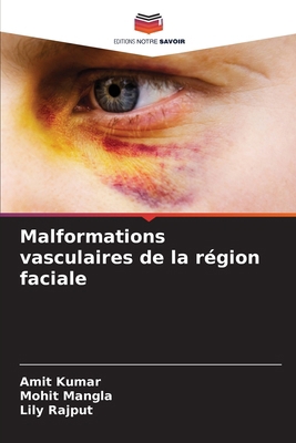 Malformations vasculaires de la région faciale [French] 6207434528 Book Cover