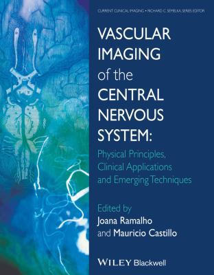 Vascular Imaging of the Central Nervous System:... 1118188756 Book Cover