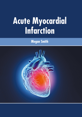 Acute Myocardial Infarction 1639270124 Book Cover