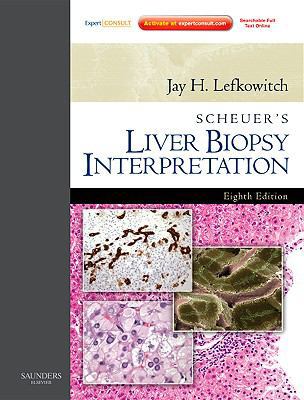 Scheuer's Liver Biopsy Interpretation: Expert C... 070203410X Book Cover