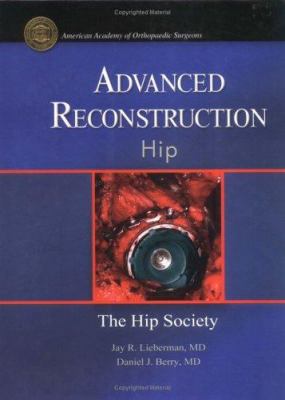 Advanced Reconstruction - Hip 0892033460 Book Cover