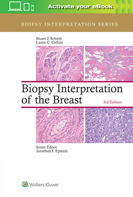 Biopsy Interpretation of the Breast 1496365755 Book Cover