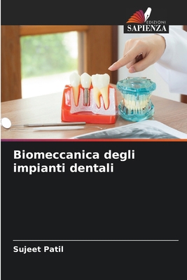 Biomeccanica degli impianti dentali [Italian] 6202367377 Book Cover