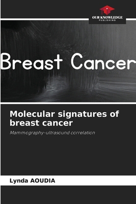 Molecular signatures of breast cancer 6207684648 Book Cover