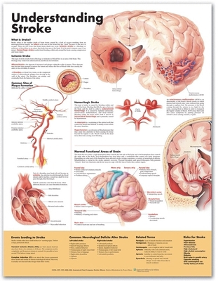 Understanding Stroke Anatomical Chart 1587799871 Book Cover