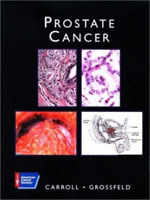Prostate Cancer (American Cancer Society Atlas ... 1550091301 Book Cover