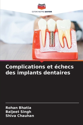 Complications et échecs des implants dentaires [French] 6208232759 Book Cover