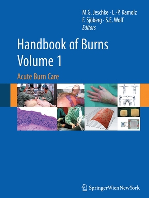 Handbook of Burns, Volume 1: Acute Burn Care 3709119189 Book Cover