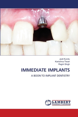 Immediate Implants 6208444144 Book Cover