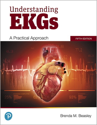 Understanding EKGs: A Practical Approach 013521341X Book Cover