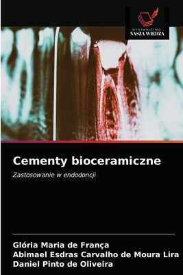 Cementy bioceramiczne [Polish] 6203336475 Book Cover