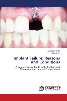 Implant Failure: Reasons and Conditions 6208442419 Book Cover