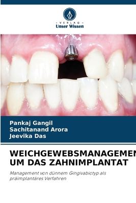 Weichgewebsmanagement Um Das Zahnimplantat [German] 6208489091 Book Cover