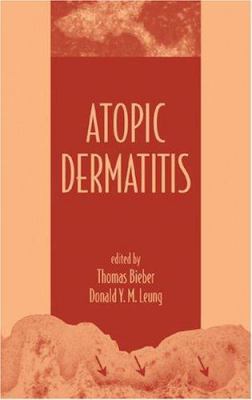 Atopic Dermatitis 0824707427 Book Cover