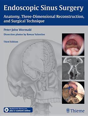 Endoscopic Sinus Surgery: Anatomy, Three-Dimens... 1604066873 Book Cover