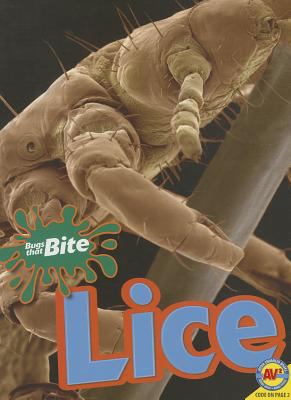 Lice 1489607714 Book Cover