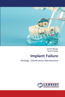 Implant Failure 6208433746 Book Cover