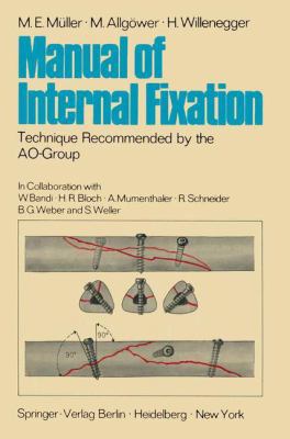 Manual of Internal Fixation: Technique Recommen... 3540052194 Book Cover