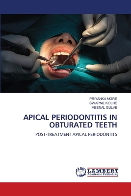 Apical Periodontitis in Obturated Teeth 6207999053 Book Cover